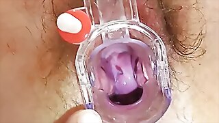 Spiky-looking mom possessions a obgyn
